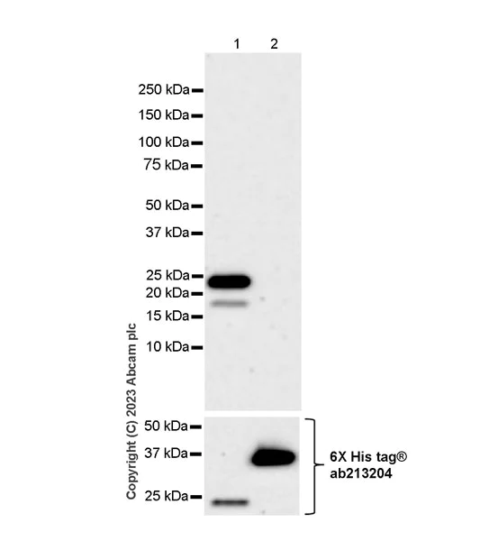 Western blot - Anti-SLC12A1/NKCC2 antibody [EPR28176-90] - BSA and Azide free (AB313641)