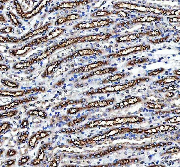 Immunohistochemistry (Formalin/PFA-fixed paraffin-embedded sections) - Anti-SLC12A1/NKCC2 antibody - N-terminal (AB191315)