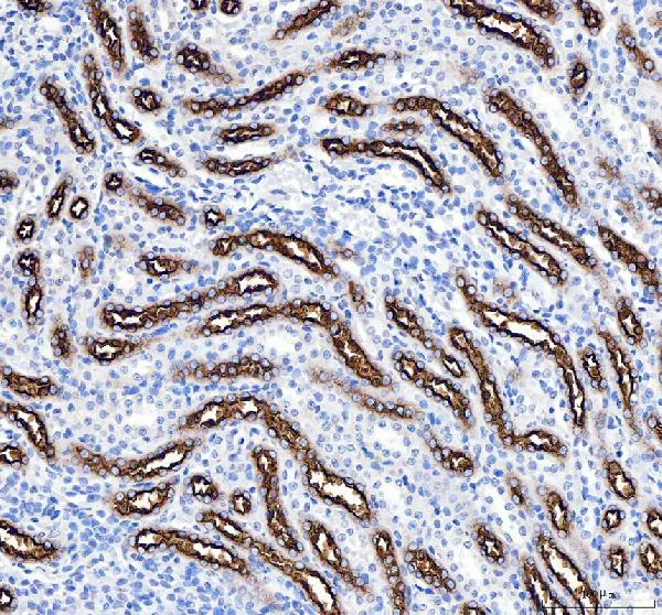 Immunohistochemistry (Formalin/PFA-fixed paraffin-embedded sections) - Anti-SLC12A1/NKCC2 antibody - N-terminal (AB191315)