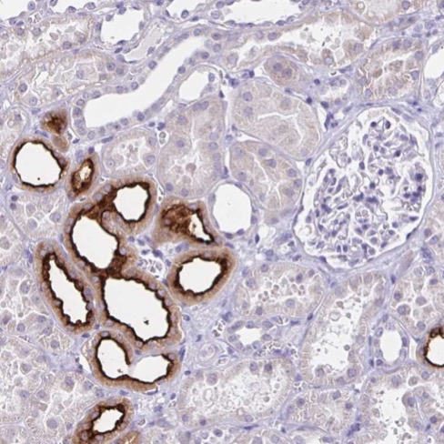 Immunohistochemistry (Formalin/PFA-fixed paraffin-embedded sections) - Anti-SLC12A3 antibody (AB224762), expandable thumbnail