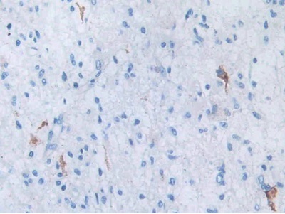 Immunohistochemistry (Formalin/PFA-fixed paraffin-embedded sections) - Anti-SLC12A3 antibody (AB233401), expandable thumbnail