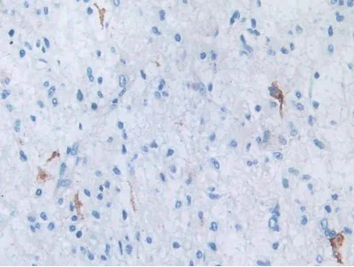 Immunohistochemistry (Formalin/PFA-fixed paraffin-embedded sections) - Anti-SLC12A3 antibody (AB233401)
