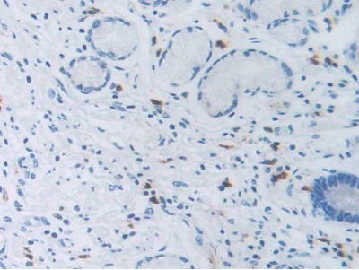 Immunohistochemistry (Formalin/PFA-fixed paraffin-embedded sections) - Anti-SLC12A3 antibody (AB233401), expandable thumbnail