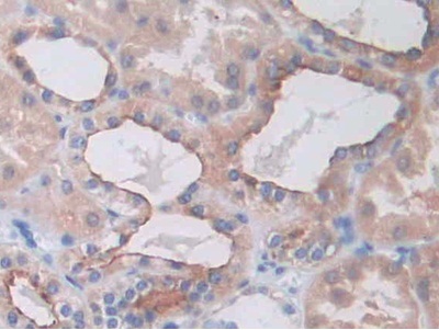 Immunohistochemistry (Formalin/PFA-fixed paraffin-embedded sections) - Anti-SLC12A3 antibody (ab233401), expandable thumbnail