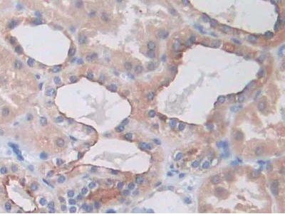 Immunohistochemistry (Formalin/PFA-fixed paraffin-embedded sections) - Anti-SLC12A3 antibody (AB233401)