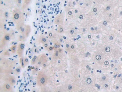 Immunohistochemistry (Formalin/PFA-fixed paraffin-embedded sections) - Anti-SLC12A3 antibody (AB233401), expandable thumbnail