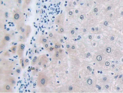 Immunohistochemistry (Formalin/PFA-fixed paraffin-embedded sections) - Anti-SLC12A3 antibody (AB233401)