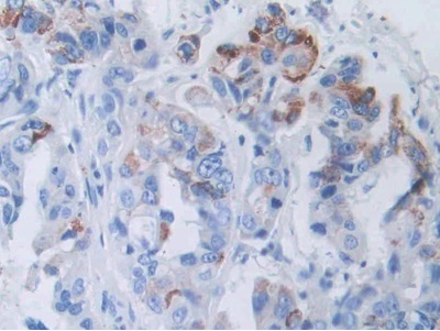 Immunohistochemistry (Formalin/PFA-fixed paraffin-embedded sections) - Anti-SLC12A3 antibody (ab233401), expandable thumbnail