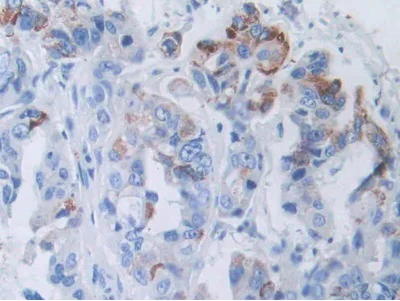 Immunohistochemistry (Formalin/PFA-fixed paraffin-embedded sections) - Anti-SLC12A3 antibody (AB233401)
