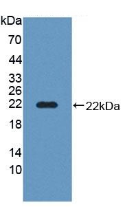 Western blot - Anti-SLC12A3 antibody (ab233401), expandable thumbnail