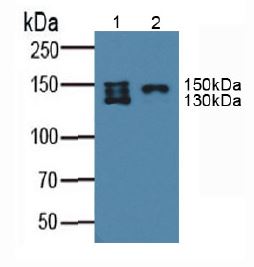 Western blot - Anti-SLC12A3 antibody (AB233401), expandable thumbnail