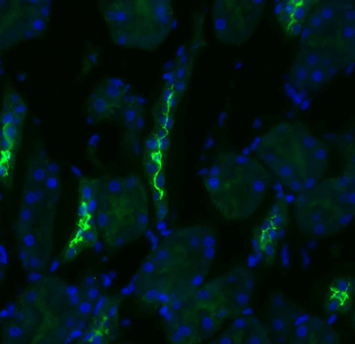 Immunocytochemistry/ Immunofluorescence - Anti-SLC12A3 antibody (AB95302), expandable thumbnail