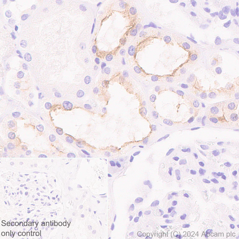 Immunohistochemistry (Formalin/PFA-fixed paraffin-embedded sections) - Anti-SLC12A3 antibody [EPR27106-48] (AB316191)