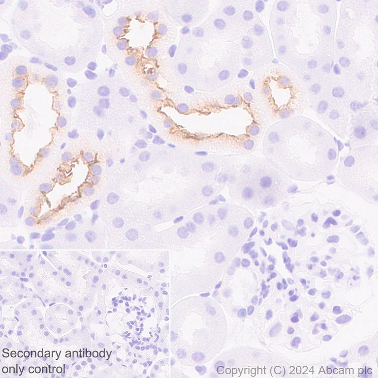 Immunohistochemistry (Formalin/PFA-fixed paraffin-embedded sections) - Anti-SLC12A3 antibody [EPR27106-48] (AB316191)