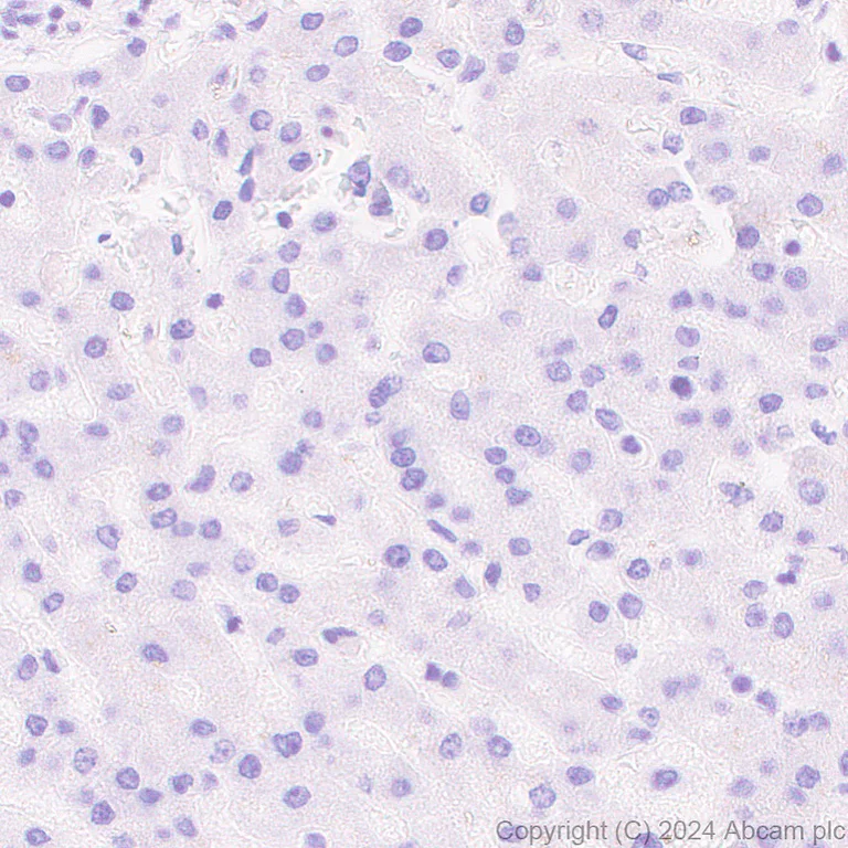 Immunohistochemistry (Formalin/PFA-fixed paraffin-embedded sections) - Anti-SLC12A3 antibody [EPR27106-48] (AB316191)