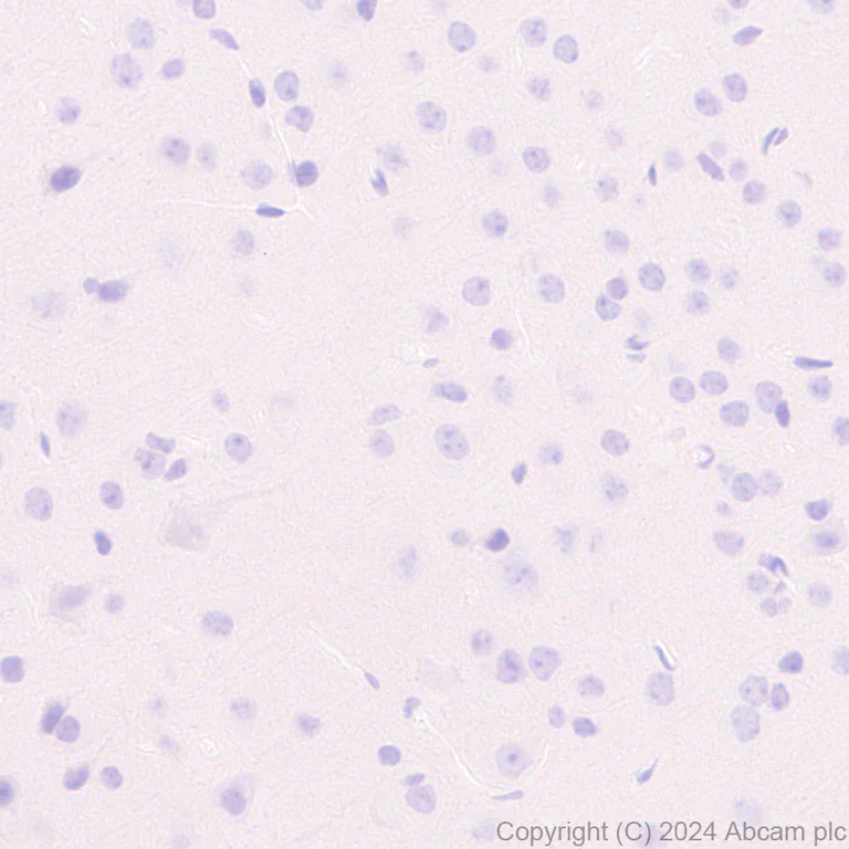 Immunohistochemistry (Formalin/PFA-fixed paraffin-embedded sections) - Anti-SLC12A3 antibody [EPR27106-48] (AB316191)