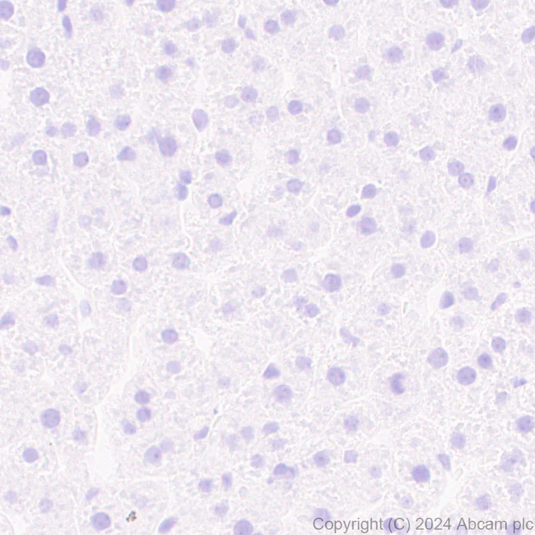 Immunohistochemistry (Formalin/PFA-fixed paraffin-embedded sections) - Anti-SLC12A3 antibody [EPR27106-48] (AB316191)
