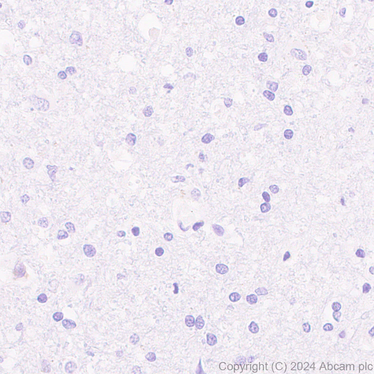 Immunohistochemistry (Formalin/PFA-fixed paraffin-embedded sections) - Anti-SLC12A3 antibody [EPR27106-48] - BSA and Azide free (AB316192)