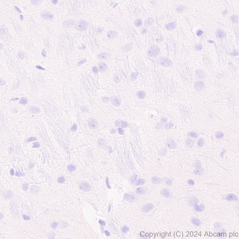Immunohistochemistry (Formalin/PFA-fixed paraffin-embedded sections) - Anti-SLC12A3 antibody [EPR27106-48] - BSA and Azide free (AB316192)
