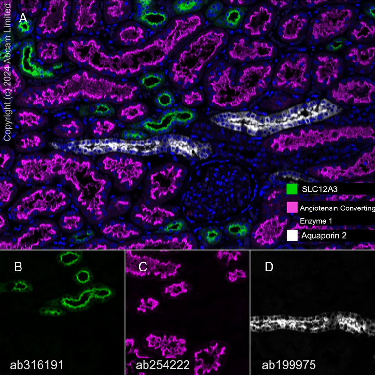 Multiplex immunohistochemistry - Anti-SLC12A3 antibody [EPR27106-48] - BSA and Azide free (AB316192)