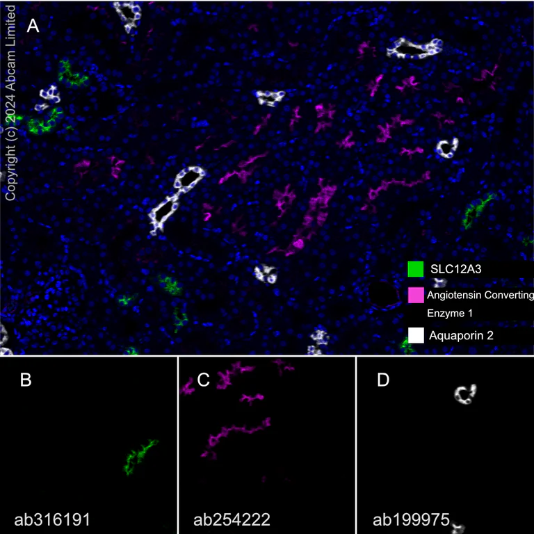 Multiplex immunohistochemistry - Anti-SLC12A3 antibody [EPR27106-48] - BSA and Azide free (AB316192)