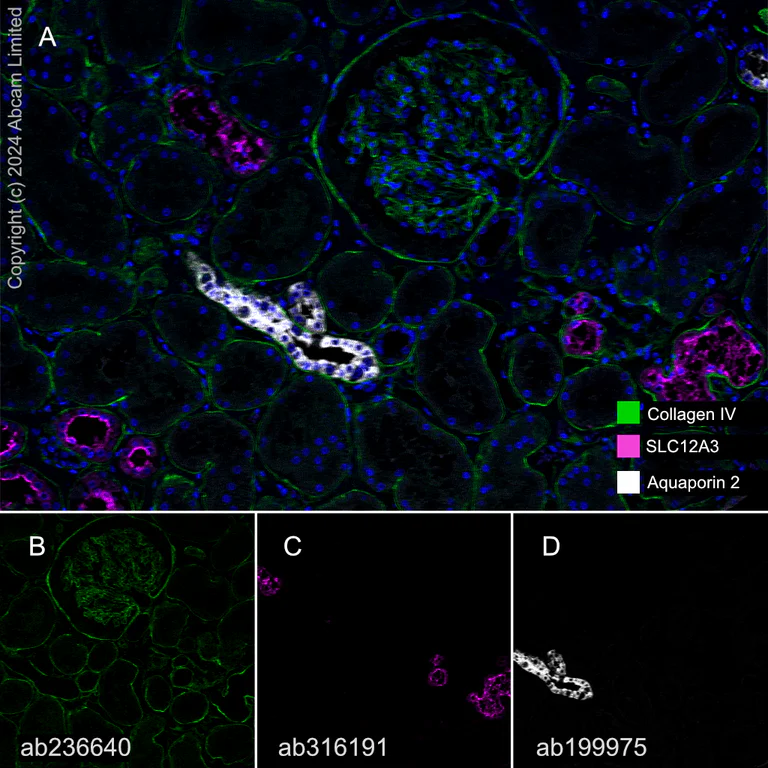 Multiplex immunohistochemistry - Anti-SLC12A3 antibody [EPR27106-48] - BSA and Azide free (AB316192)
