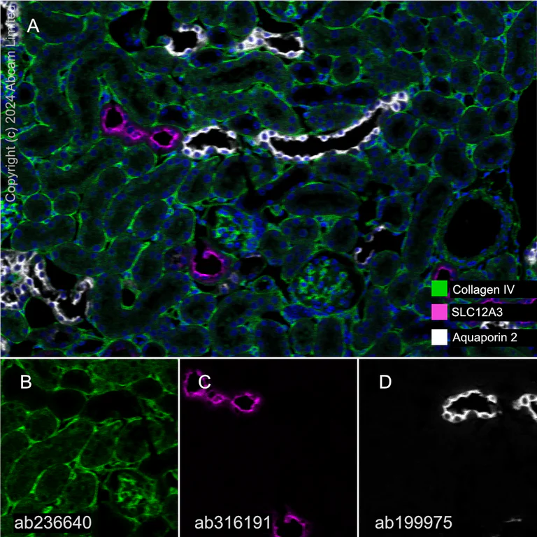 Multiplex immunohistochemistry - Anti-SLC12A3 antibody [EPR27106-48] - BSA and Azide free (AB316192)