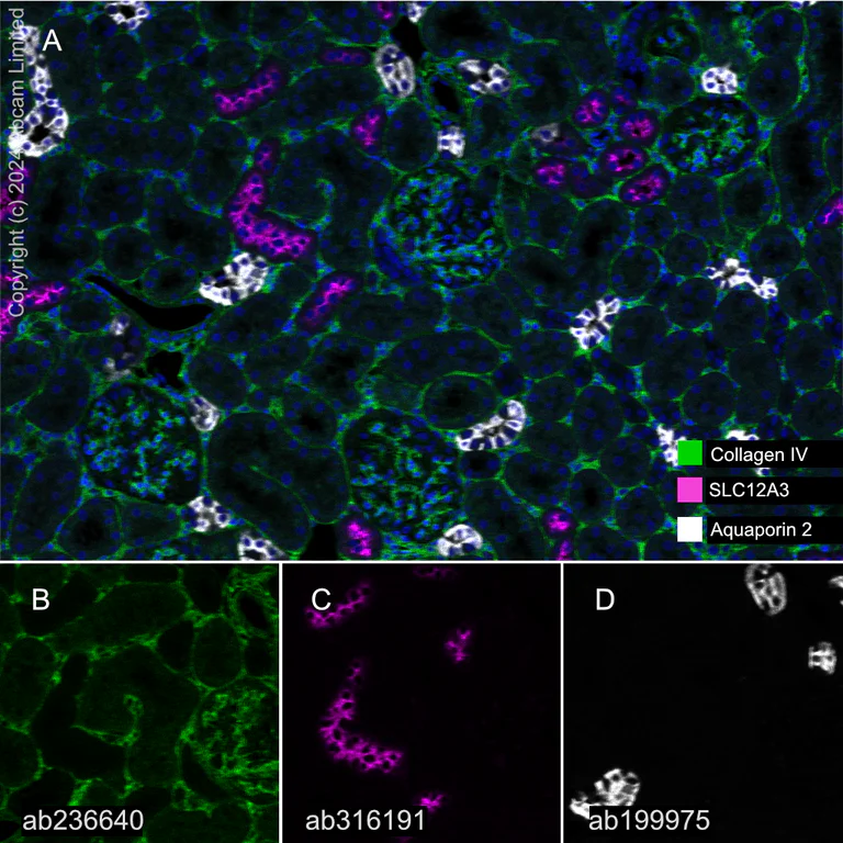 Multiplex immunohistochemistry - Anti-SLC12A3 antibody [EPR27106-48] - BSA and Azide free (AB316192)
