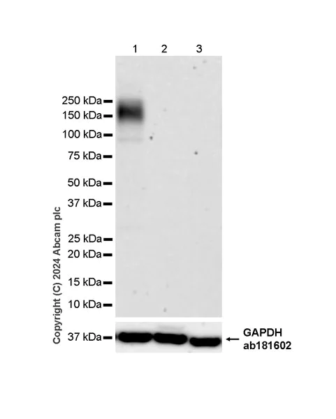 Western blot - Anti-SLC12A3 antibody [EPR27106-48] - BSA and Azide free (AB316192)