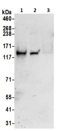 Western blot - Anti-SLC12A6/KCC3 antibody (AB241348)