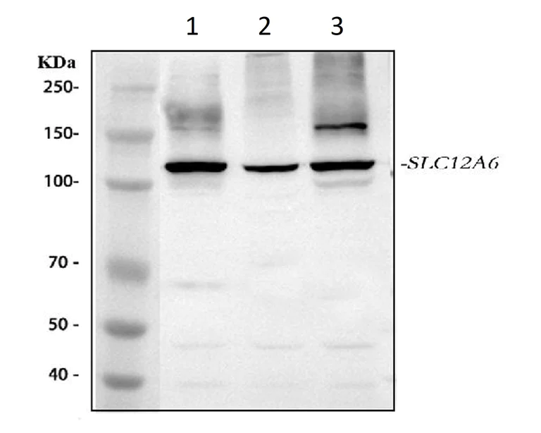 Western blot - Anti-SLC12A6/KCC3 antibody - C-terminal (AB191451)