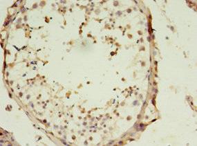 Immunohistochemistry (Formalin/PFA-fixed paraffin-embedded sections) - Anti-SLC13A4/SUT1 antibody (AB236619), expandable thumbnail