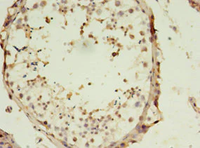 Immunohistochemistry (Formalin/PFA-fixed paraffin-embedded sections) - Anti-SLC13A4/SUT1 antibody (AB236619)