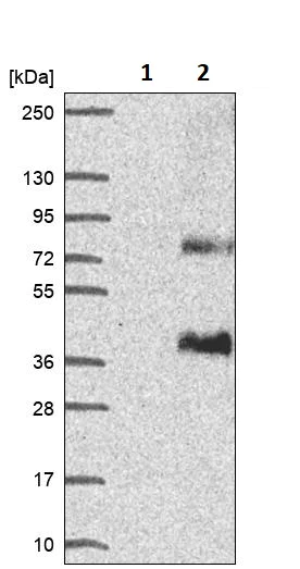 Western blot - Anti-SLC13A5 antibody (AB247057)