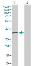 Western blot - Anti-SLC14A1/UTE antibody (AB103295), expandable thumbnail