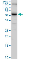 Western blot - Anti-SLC14A1/UTE antibody (AB103295), expandable thumbnail