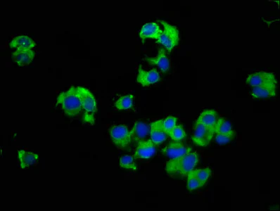 Immunocytochemistry/ Immunofluorescence - Anti-SLC14A1/UTE antibody (AB238721)
