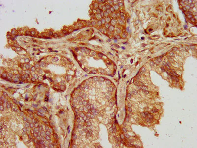 Immunohistochemistry (Formalin/PFA-fixed paraffin-embedded sections) - Anti-SLC14A1/UTE antibody (AB238721)