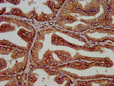 Immunohistochemistry (Formalin/PFA-fixed paraffin-embedded sections) - Anti-SLC14A1/UTE antibody (AB238721)