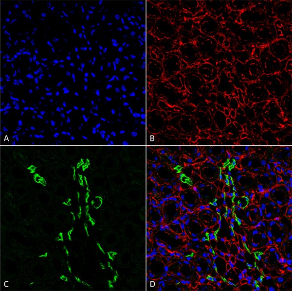Immunohistochemistry (Formalin/PFA-fixed paraffin-embedded sections) - Anti-SLC14A2 antibody (AB95365)