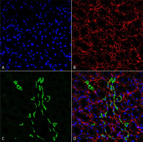 Immunohistochemistry (Formalin/PFA-fixed paraffin-embedded sections) - Anti-SLC14A2 antibody (AB95365)