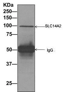 Immunoprecipitation - Anti-SLC14A2 antibody [EPR8620] - BSA and Azide free (AB249277)