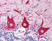 Immunohistochemistry (Formalin/PFA-fixed paraffin-embedded sections) - Anti-SLC15A1/PEPT1 antibody (AB78020), expandable thumbnail
