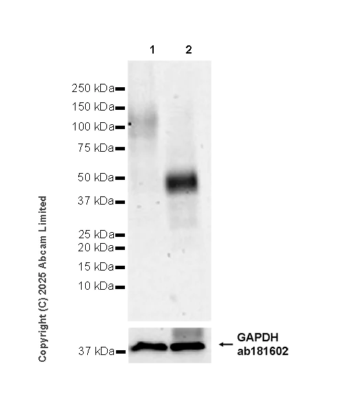 Western blot - Anti-SLC15A4/PHT1 antibody [EPR26040-123] (AB324433)