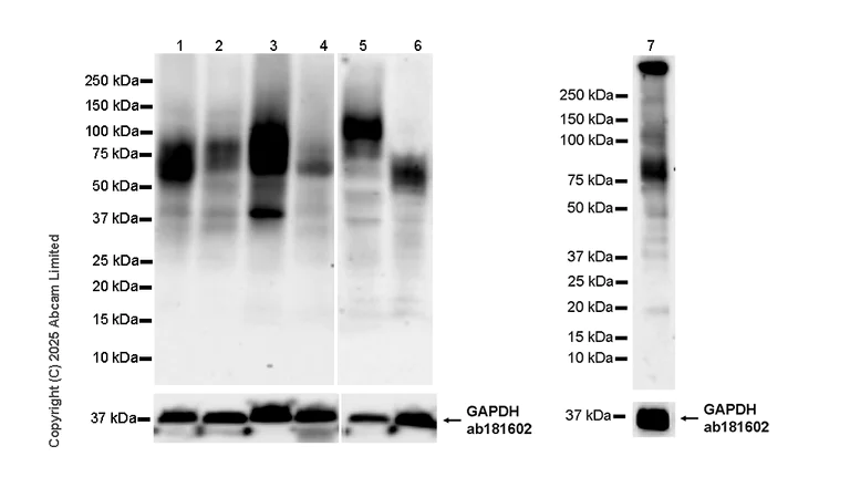 Western blot - Anti-SLC15A4/PHT1 antibody [EPR26040-123] (AB324433)