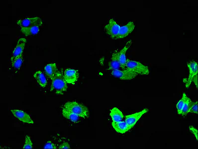 Immunocytochemistry/ Immunofluorescence - Anti-SLC16A3/MCT 4 antibody (AB234728)