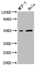 Western blot - Anti-SLC16A3/MCT 4 antibody (AB234728)