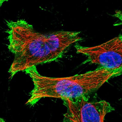 Immunocytochemistry/ Immunofluorescence - Anti-SLC16A3/MCT 4 antibody (AB244385)