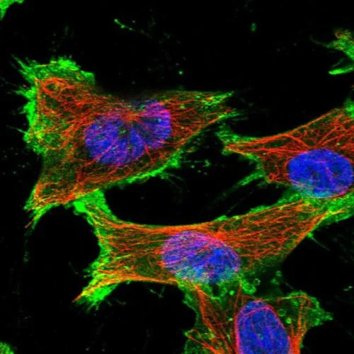 Immunocytochemistry/ Immunofluorescence - Anti-SLC16A3/MCT 4 antibody (AB244385)