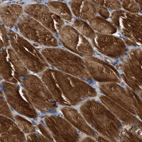 Immunohistochemistry (Formalin/PFA-fixed paraffin-embedded sections) - Anti-SLC16A3/MCT 4 antibody (AB244385)